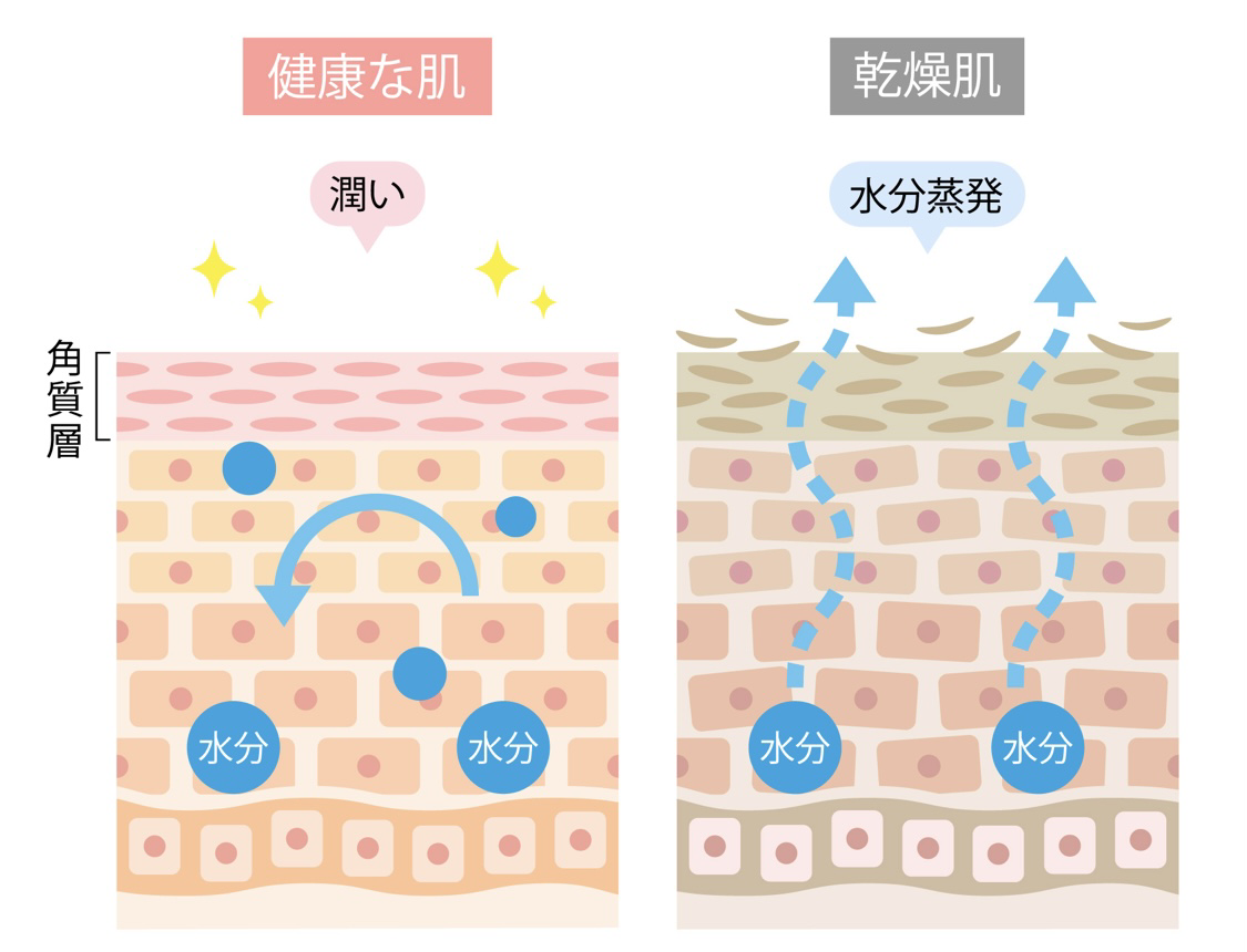 保湿においての断面図の画像です。健康な肌、うるおい、角質層、水分、乾燥肌、水分蒸発。
